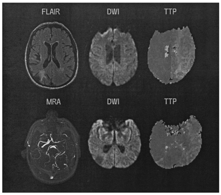 Fig 2.