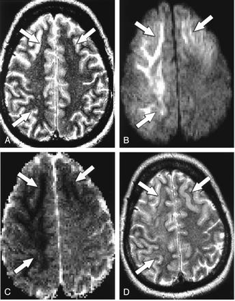 Fig 2.