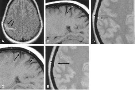 Fig 2.
