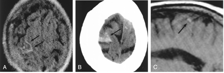 Fig 3.