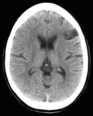 Fig 1.