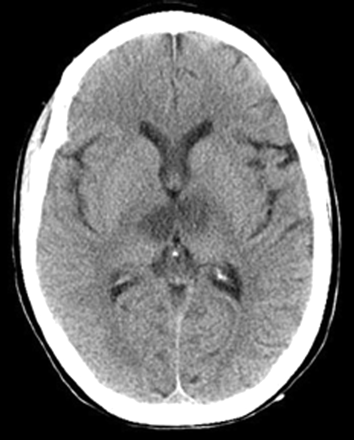 Fig 3.