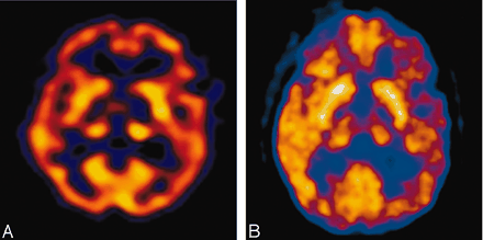 Fig 4.