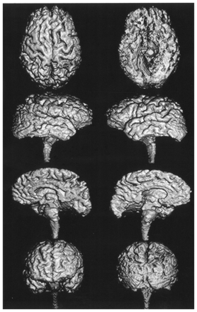 Fig 2.