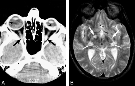 Fig 1.