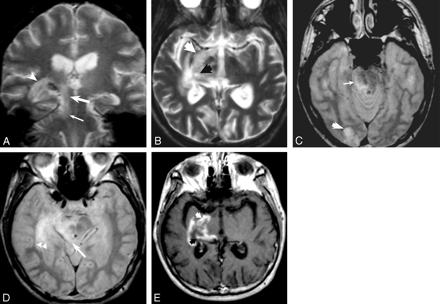 Fig 3.
