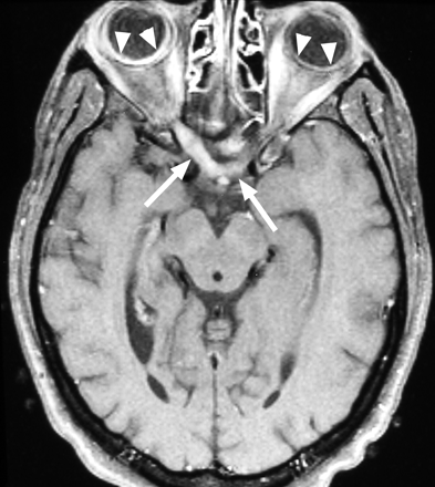 Fig 4.