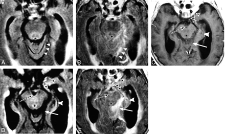 Fig 5.