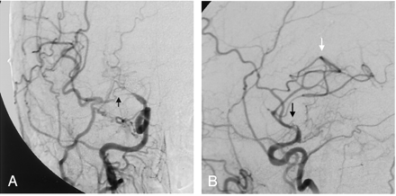 Fig 5.