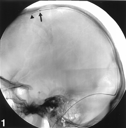 Fig 1.