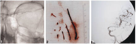 Fig 3.