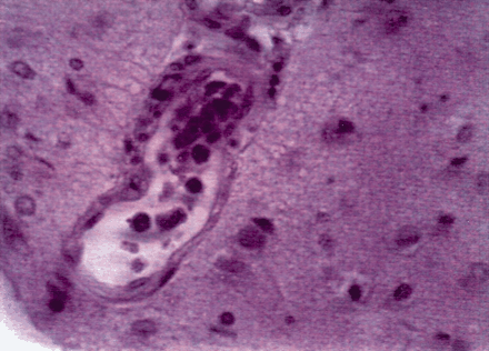 Fig 4.