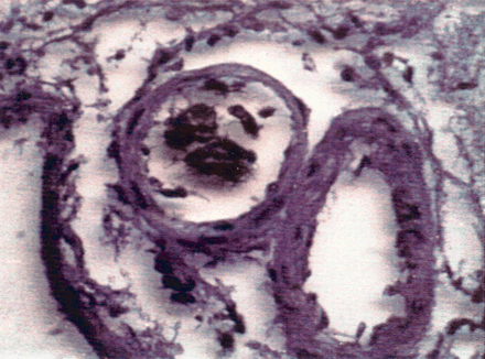 Fig 5.