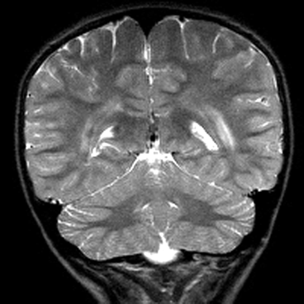 Fig 2.