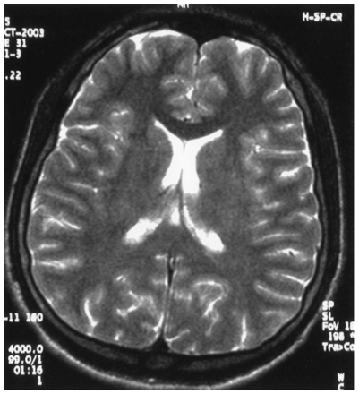 Fig 2.