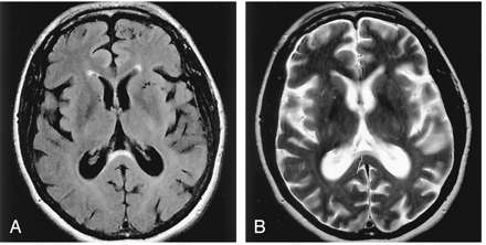 Fig 1.
