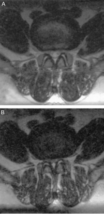 Fig 2.