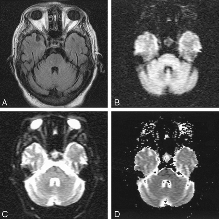Fig 2.