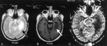 Fig 2.