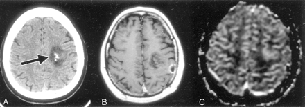 Fig 4.