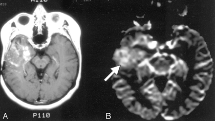 Fig 9.