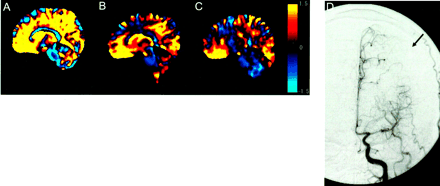 Fig 3.