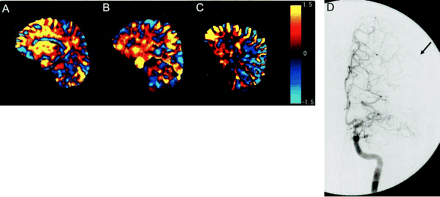 Fig 4.