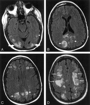 Fig 1.