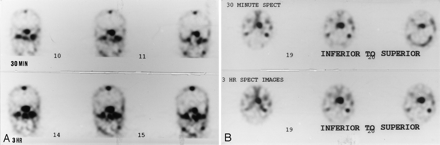 Fig 2.