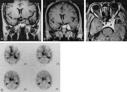 Fig 3.