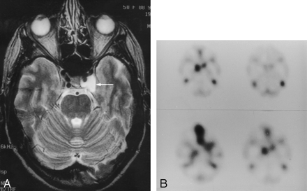 Fig 4.