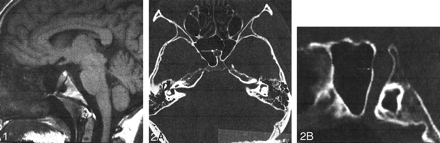 Fig 1.