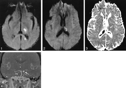 Fig 2.