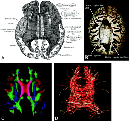 Fig 14.