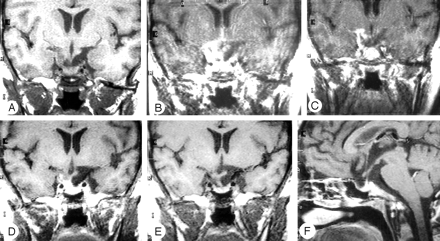 Fig 3.