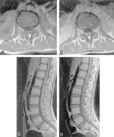 Fig 4.
