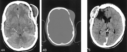 Fig 5.