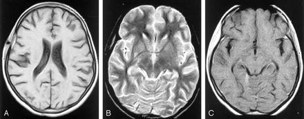 Fig 7.