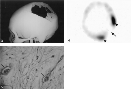 Fig 3.