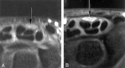 Fig 1.