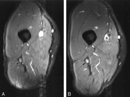 Fig 7.