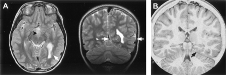 Fig 10.