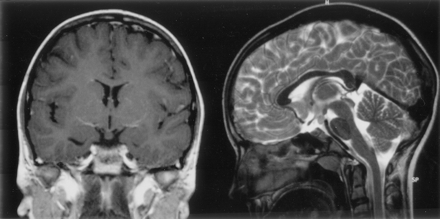 Fig 2.