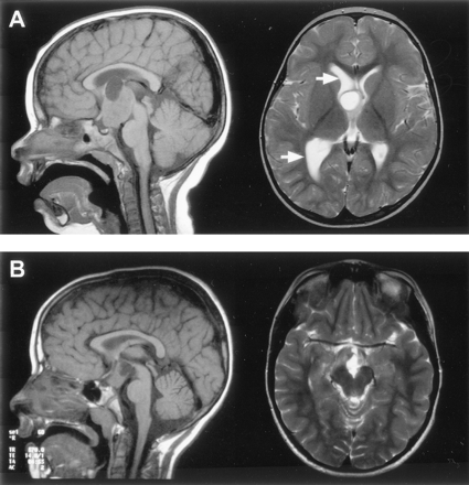 Fig 3.