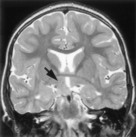 Fig 4.