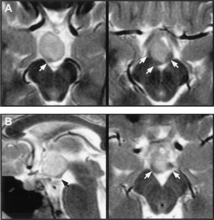 Fig 6.