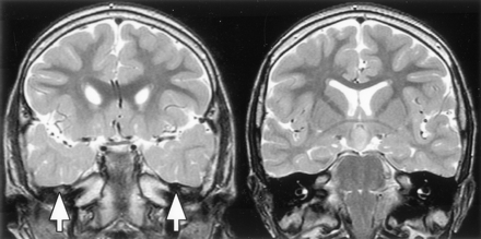 Fig 8.