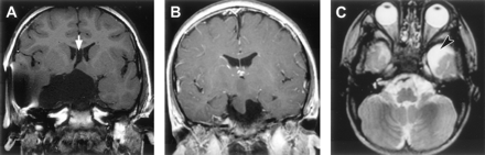 Fig 9.