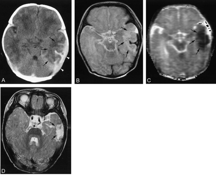 Fig 3.