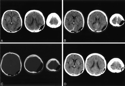 Fig 1.